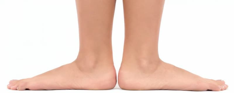 cause of flat feet